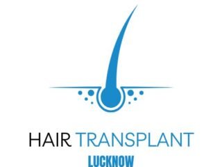 HAIR-TRANSPLANT-IN-LUCKNOW
