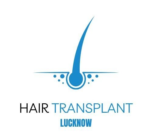 Hair Transplant Lucknow